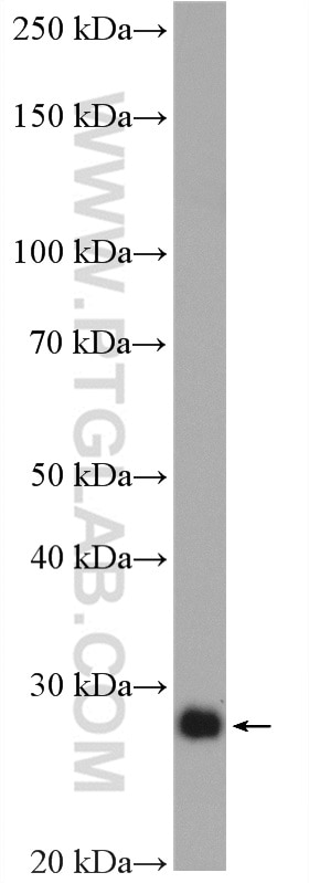 Western Blot (WB) analysis of HeLa cells using P27; KIP1 Polyclonal antibody (25614-1-AP)