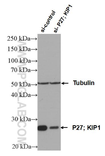 Western Blot (WB) analysis of HeLa cells using P27; KIP1 Polyclonal antibody (25614-1-AP)