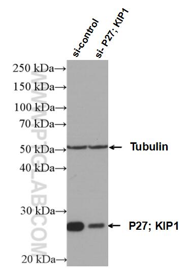 WB analysis of HeLa using 25614-1-AP