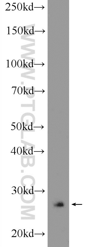 P27; KIP1 Polyclonal antibody