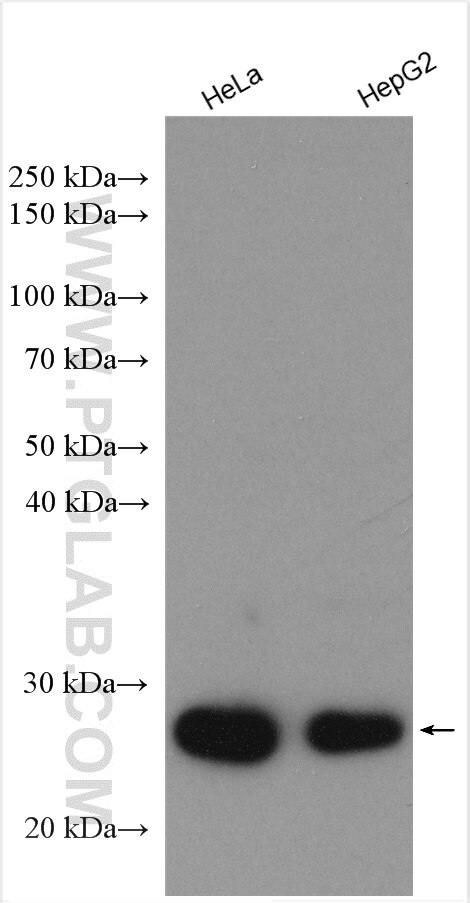 Western Blot (WB) analysis of various lysates using P27; KIP1 Polyclonal antibody (25614-1-AP)