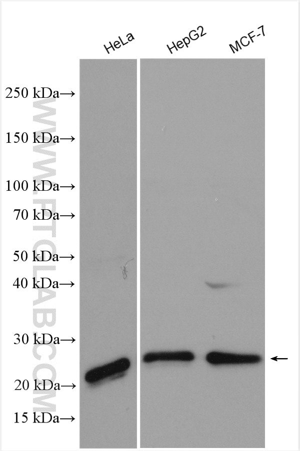 Western Blot (WB) analysis of various lysates using P27; KIP1 Polyclonal antibody (25614-1-AP)