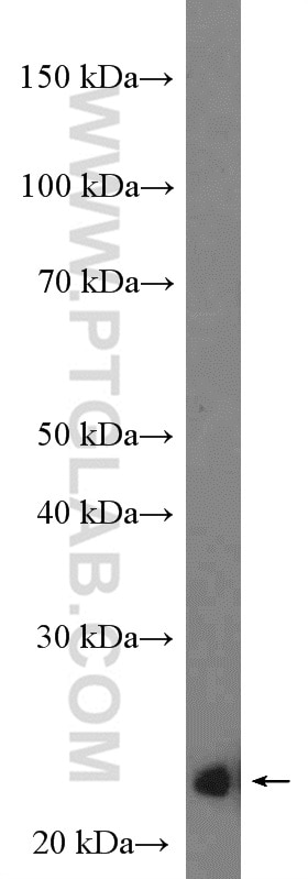 Western Blot (WB) analysis of NIH/3T3 cells using P27; KIP1 Polyclonal antibody (25614-1-AP)