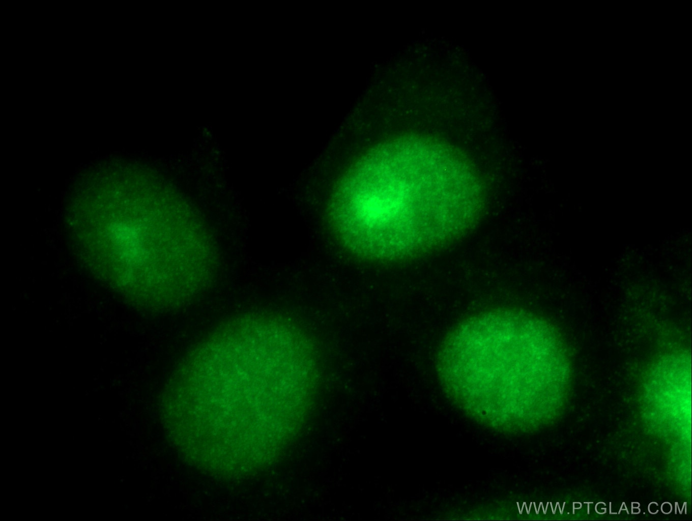 Immunofluorescence (IF) / fluorescent staining of MCF-7 cells using P27; KIP1 Polyclonal antibody (26714-1-AP)