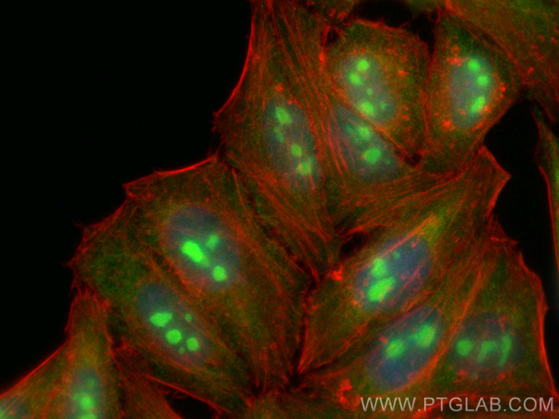 Immunofluorescence (IF) / fluorescent staining of HepG2 cells using P27; KIP1 Polyclonal antibody (26714-1-AP)