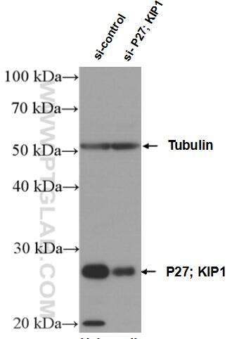 Western Blot (WB) analysis of HeLa cells using P27; KIP1 Polyclonal antibody (26714-1-AP)