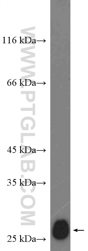 Western Blot (WB) analysis of NIH/3T3 cells using P27; KIP1 Polyclonal antibody (26714-1-AP)