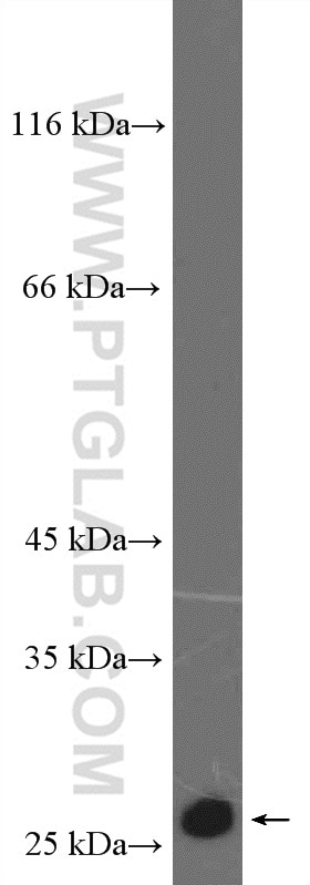 Western Blot (WB) analysis of MCF-7 cells using P27; KIP1 Polyclonal antibody (26714-1-AP)