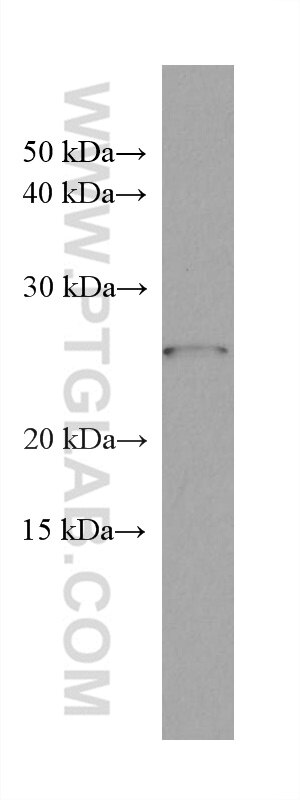 Western Blot (WB) analysis of K-562 cells using P27; KIP1 Monoclonal antibody (67355-1-Ig)