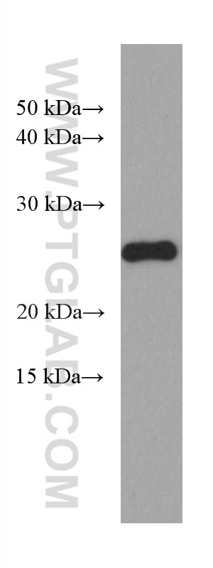 Western Blot (WB) analysis of Jurkat cells using P27; KIP1 Monoclonal antibody (67355-1-Ig)