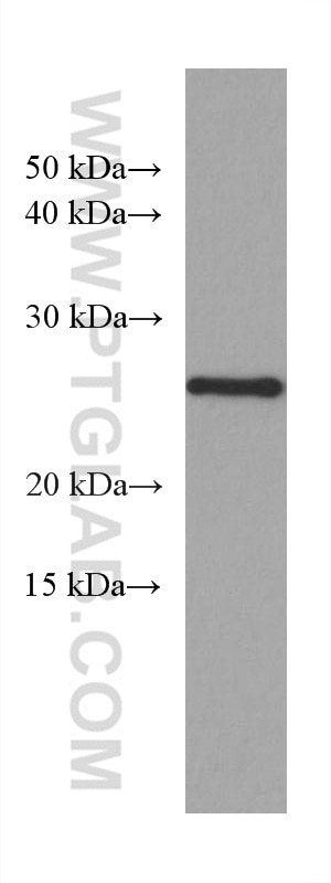 Western Blot (WB) analysis of HSC-T6 cells using P27; KIP1 Monoclonal antibody (67355-1-Ig)