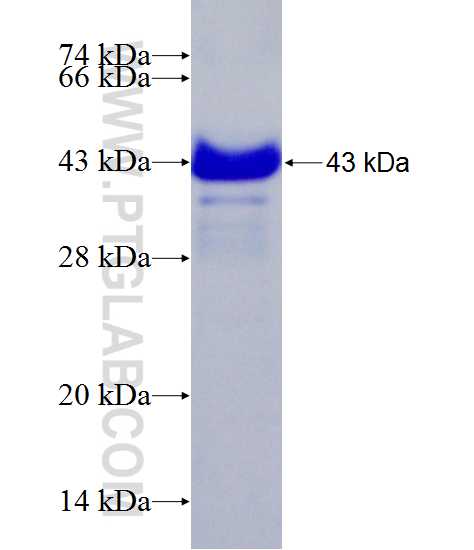 P27; KIP1 fusion protein Ag22582 SDS-PAGE