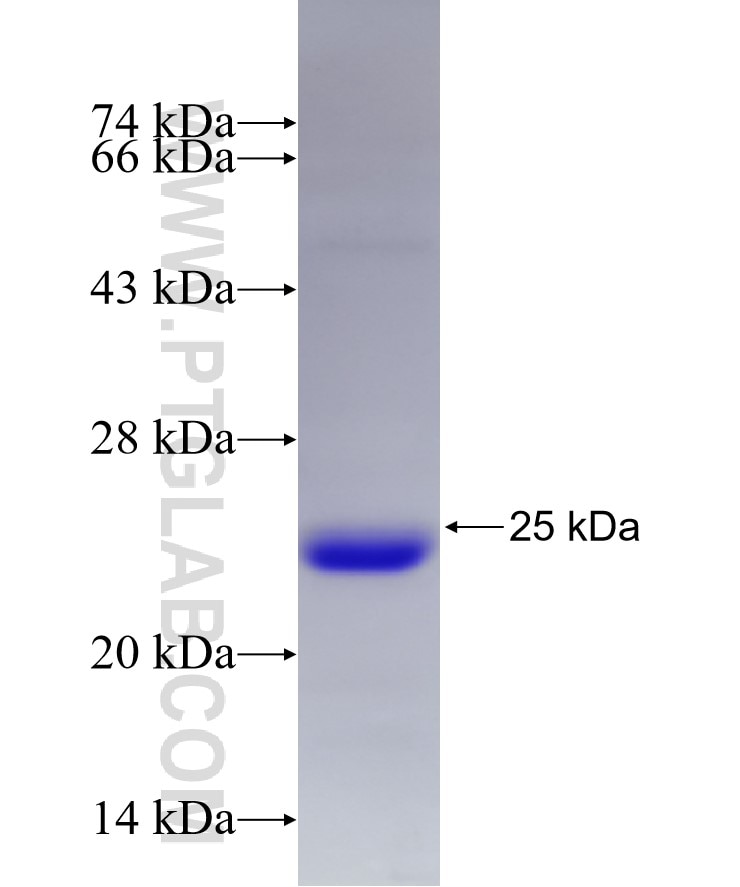 P27; KIP1 fusion protein Ag22596 SDS-PAGE