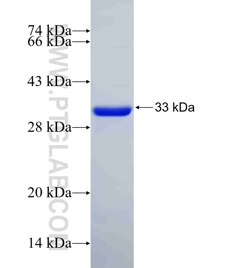 P27; KIP1 fusion protein Ag25083 SDS-PAGE