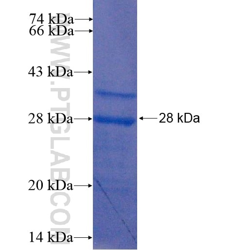 P27; KIP1 fusion protein Ag14634 SDS-PAGE