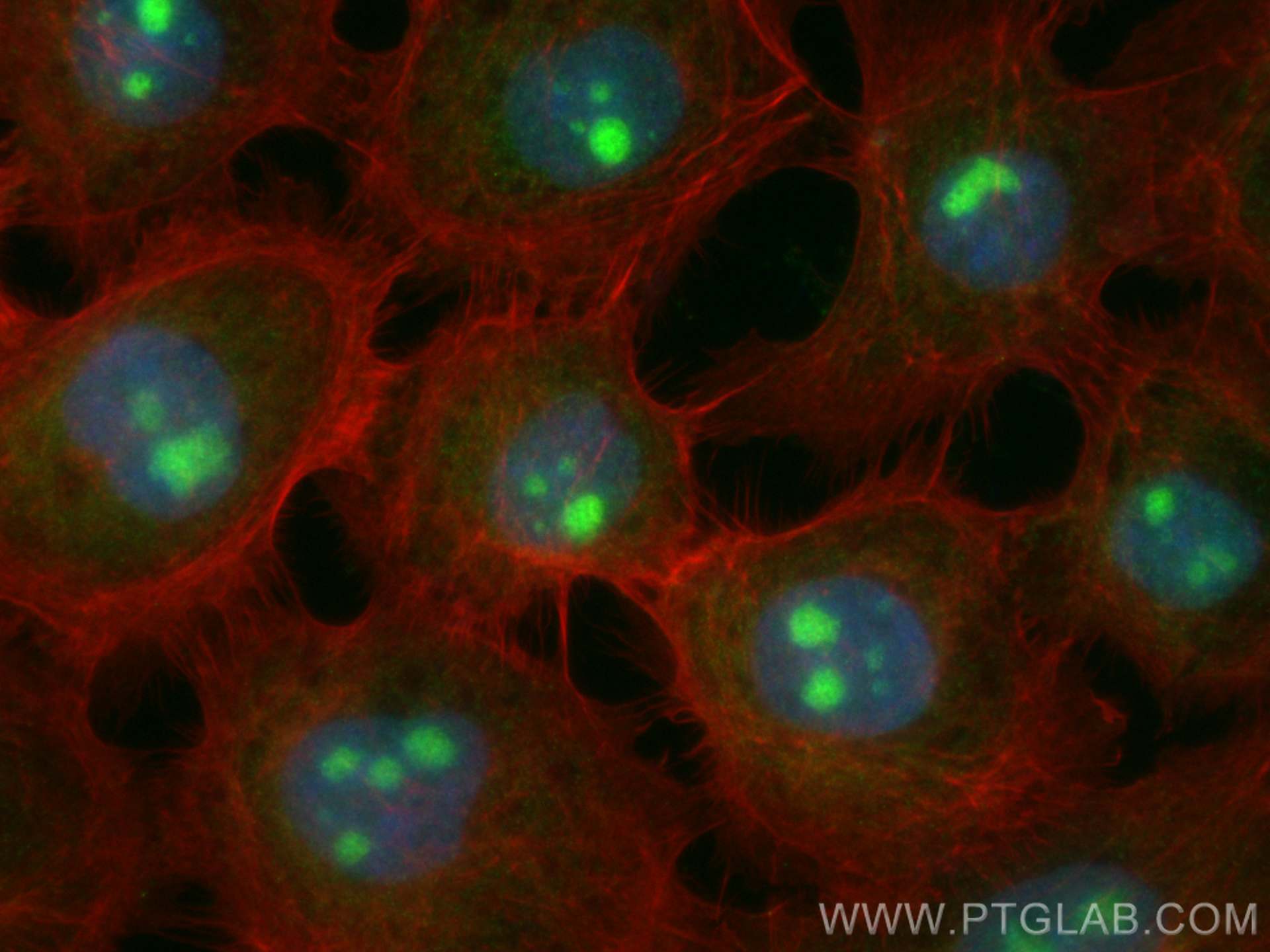 Immunofluorescence (IF) / fluorescent staining of A431 cells using CoraLite® Plus 488-conjugated P27; KIP1 Polyclonal (CL488-26714)