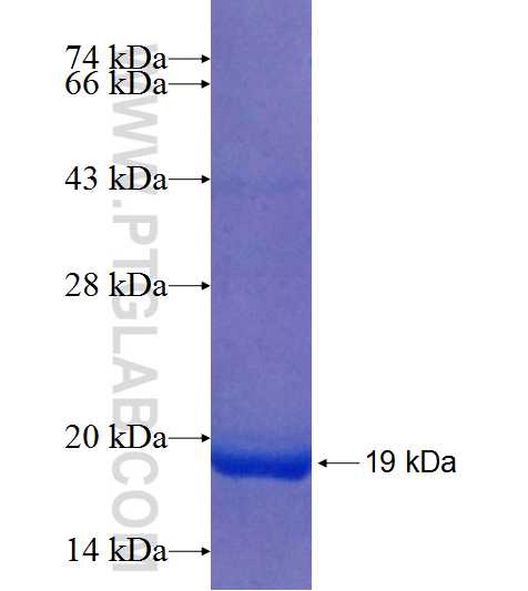 P2RX1 fusion protein Ag25279 SDS-PAGE