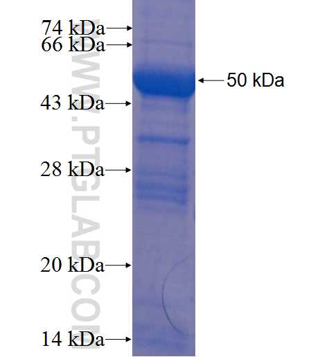 P2RX2 fusion protein Ag22904 SDS-PAGE