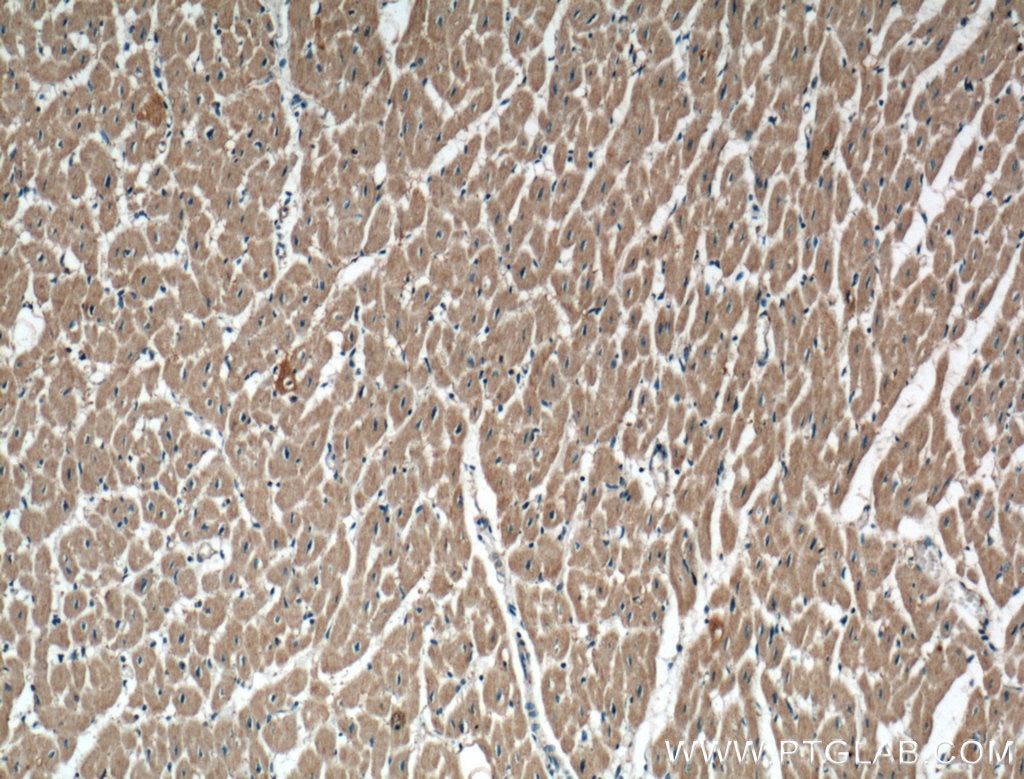 IHC staining of human heart using 17843-1-AP