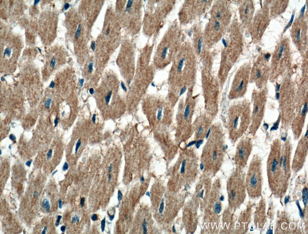 Immunohistochemistry (IHC) staining of human heart tissue using P2RX3 Polyclonal antibody (17843-1-AP)