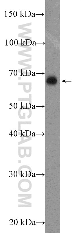 Western Blot (WB) analysis of Jurkat cells using P2RX3 Polyclonal antibody (17843-1-AP)