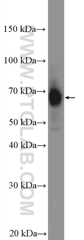 Western Blot (WB) analysis of Jurkat cells using P2RX3 Polyclonal antibody (17843-1-AP)