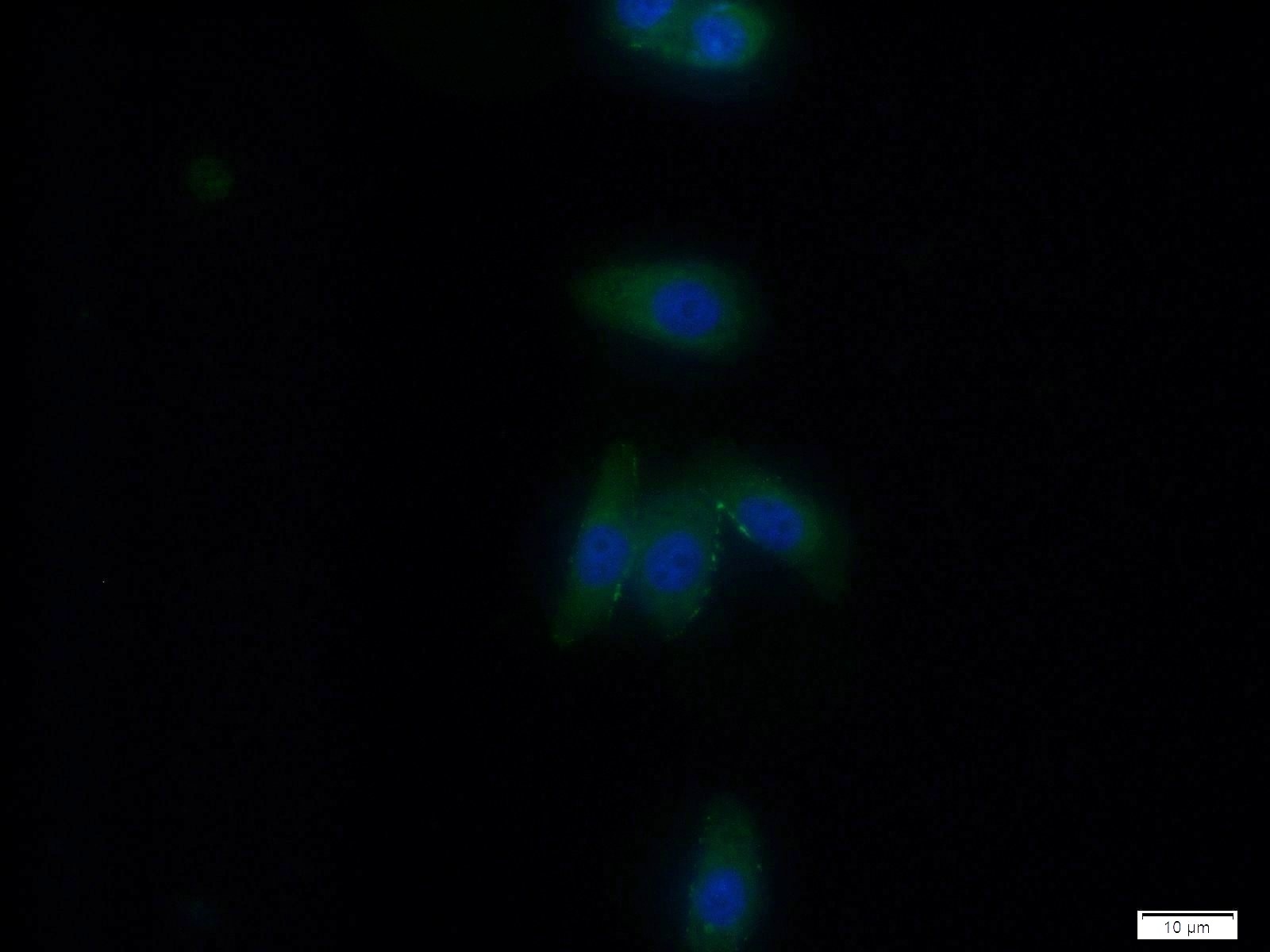 IF Staining of HeLa using 13534-1-AP