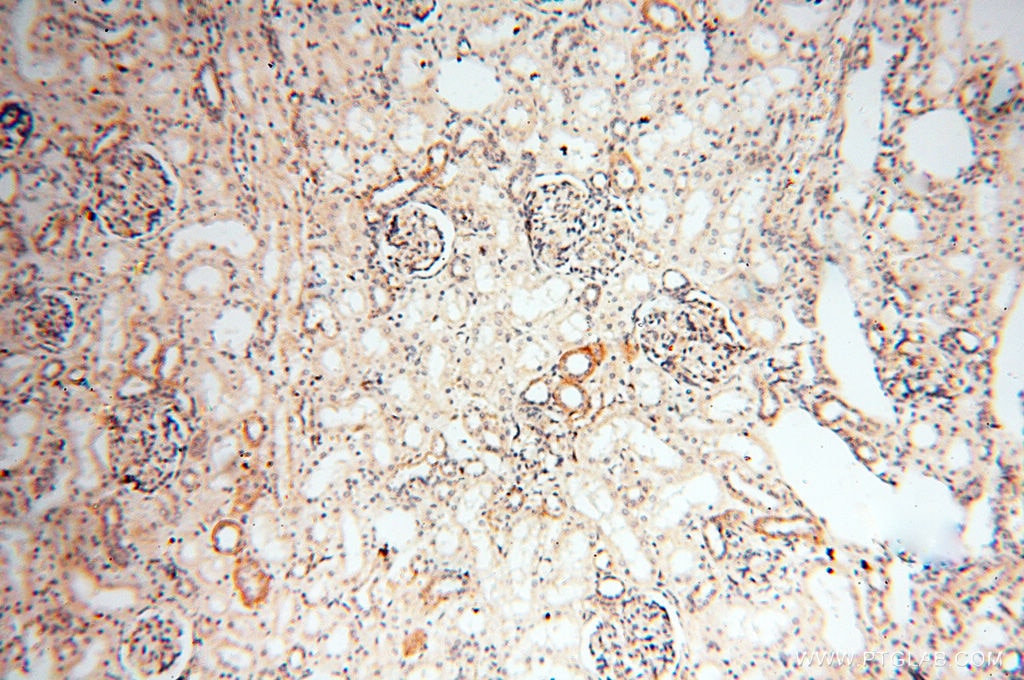 IHC staining of human kidney using 13534-1-AP
