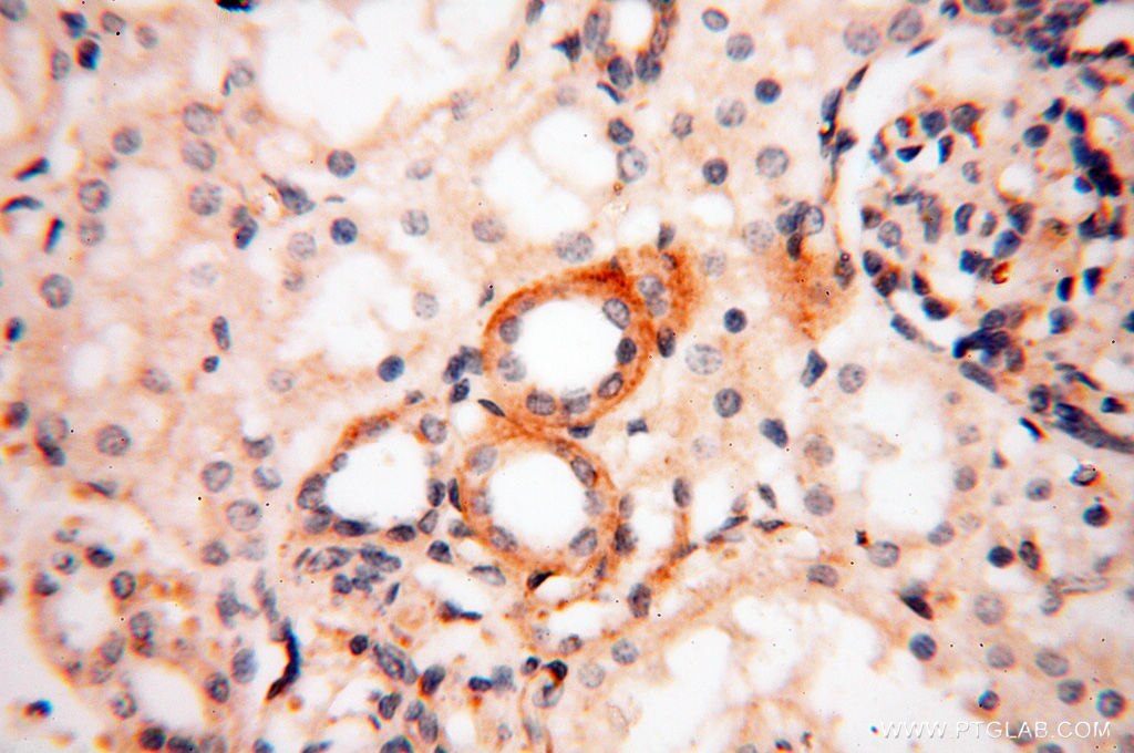 IHC staining of human kidney using 13534-1-AP