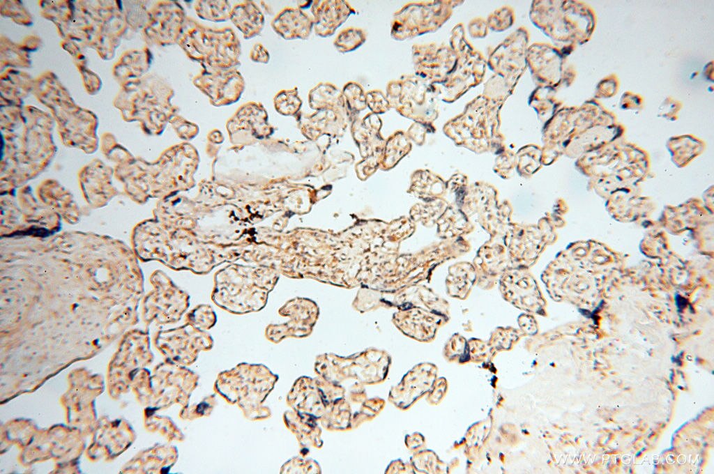 IHC staining of human placenta using 13534-1-AP