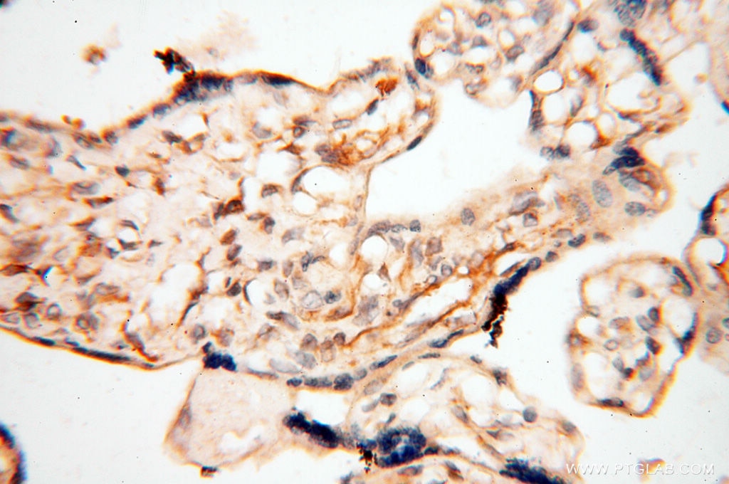 IHC staining of human placenta using 13534-1-AP
