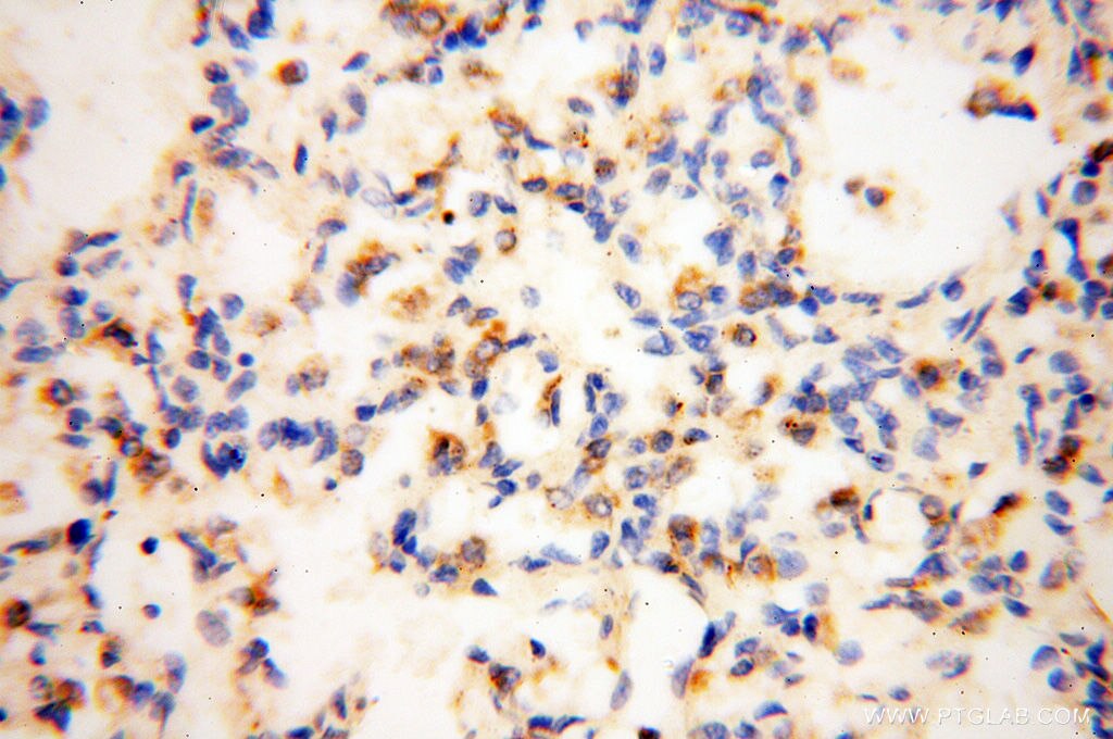 IHC staining of human lung using 13534-1-AP