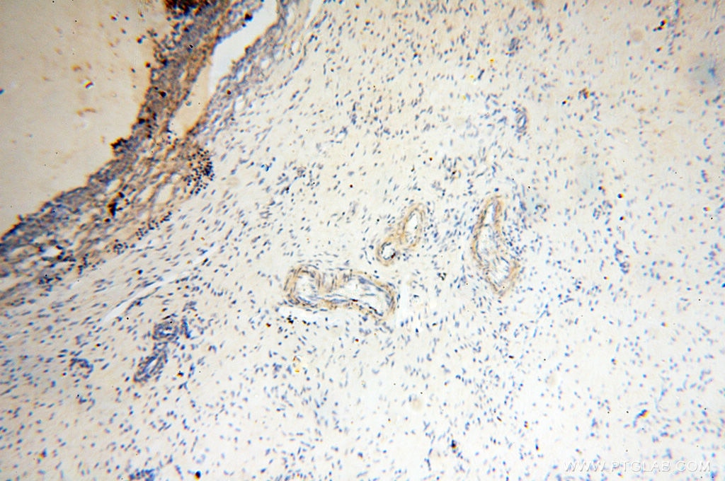 IHC staining of human ovary using 13534-1-AP