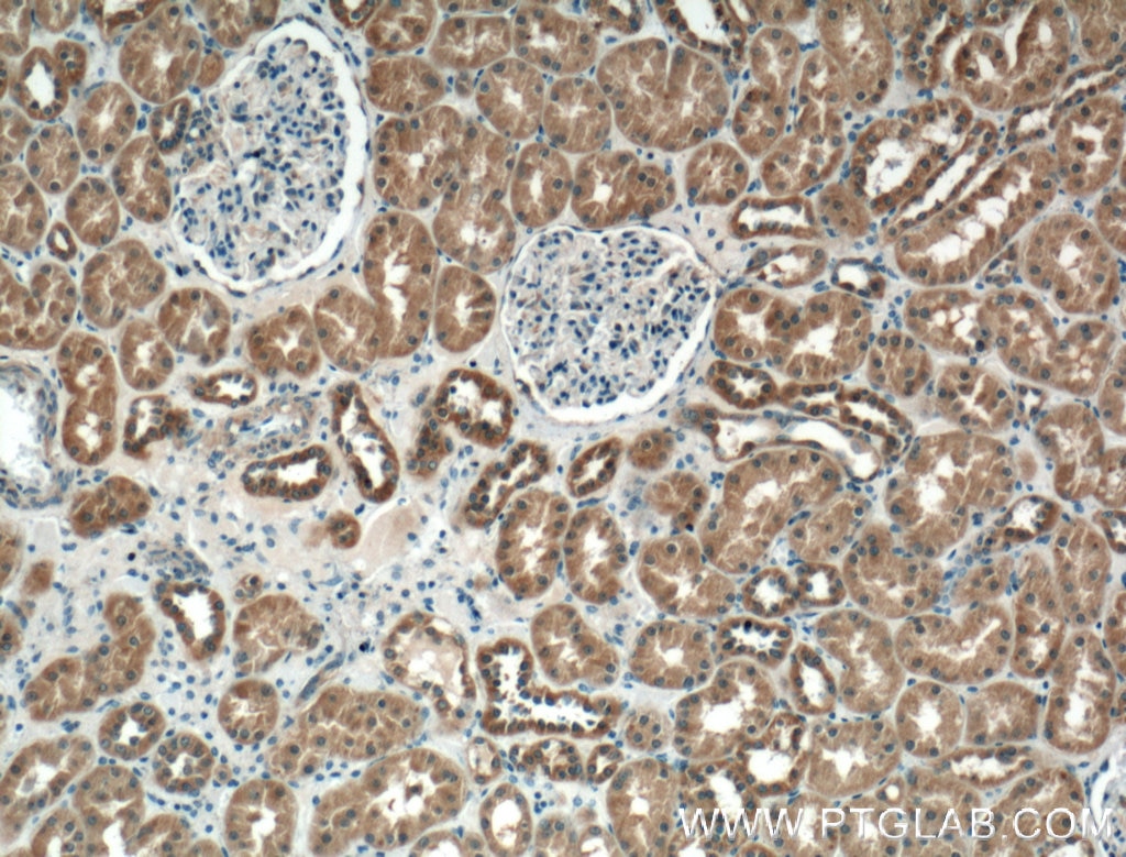 Immunohistochemistry (IHC) staining of human kidney tissue using P2RX4 Monoclonal antibody (66416-1-Ig)