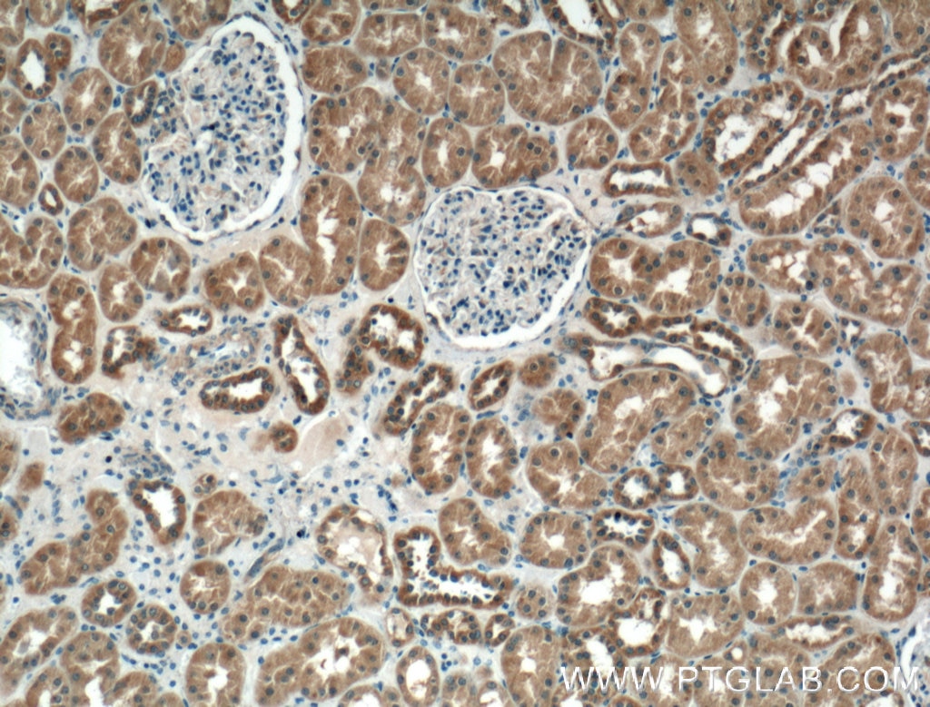 IHC staining of human kidney using 66416-1-Ig