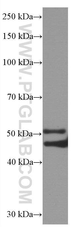 Western Blot (WB) analysis of rat brain tissue using P2RX4 Monoclonal antibody (66416-1-Ig)
