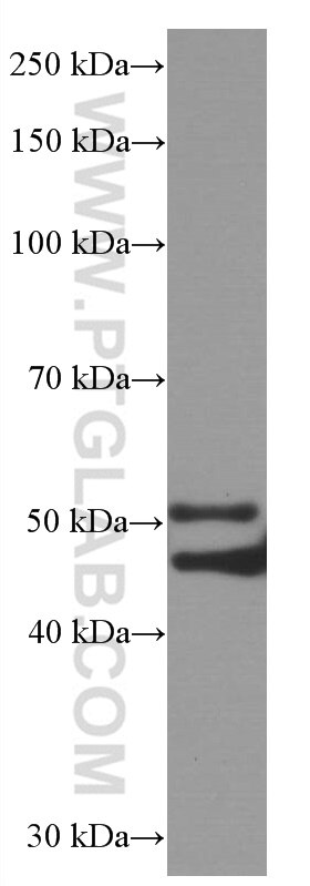 WB analysis of rat brain using 66416-1-Ig