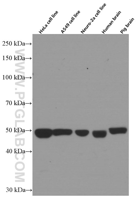 Western Blot (WB) analysis of various lysates using P2RX4 Monoclonal antibody (66416-1-Ig)