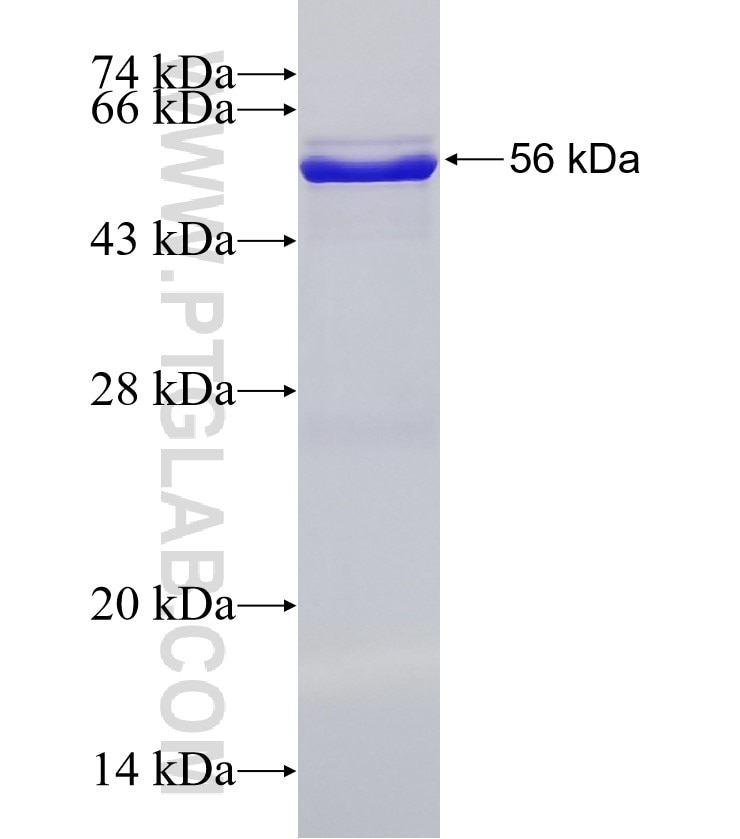 P2RX4 fusion protein Ag4445 SDS-PAGE