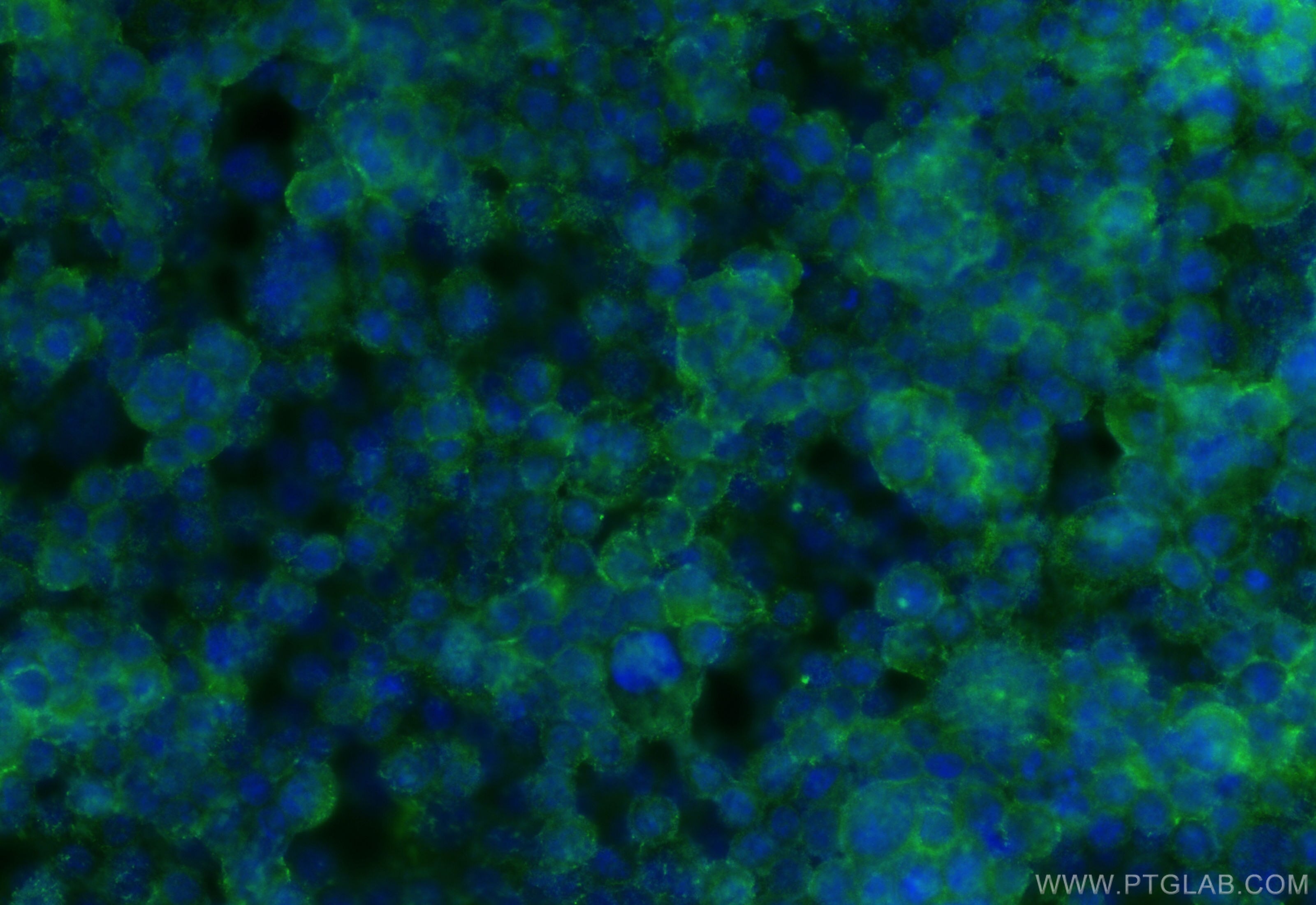 Immunofluorescence (IF) / fluorescent staining of BxPC-3 cells using P2RX5 Polyclonal antibody (19012-1-AP)