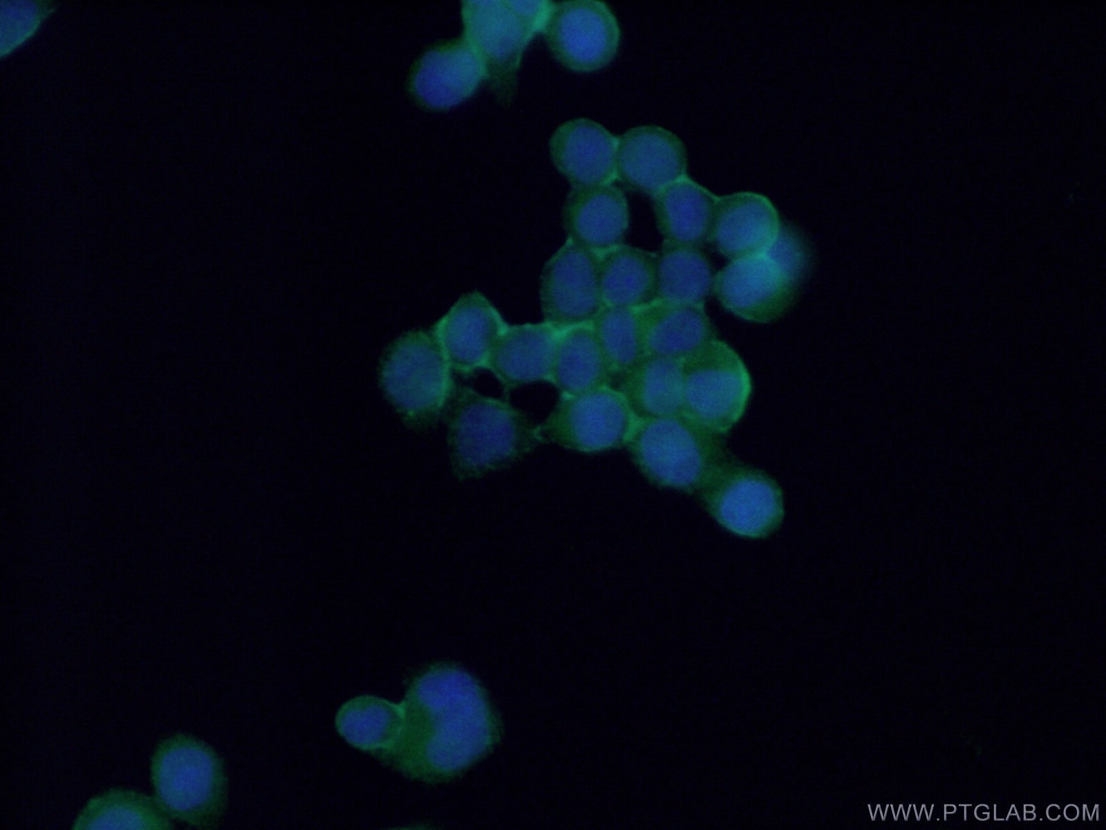 Immunofluorescence (IF) / fluorescent staining of BxPC-3 cells using P2RX5 Polyclonal antibody (19012-1-AP)