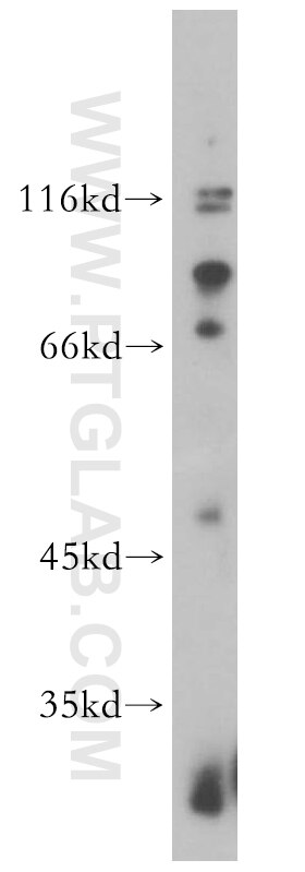 Western Blot (WB) analysis of MDA-MB-453s cells using P2RX5 Polyclonal antibody (19012-1-AP)