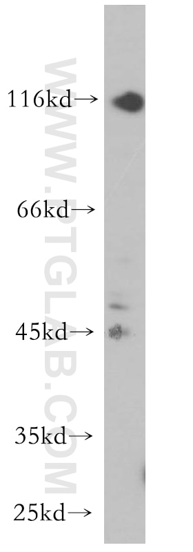 Western Blot (WB) analysis of BxPC-3 cells using P2RX5 Polyclonal antibody (19012-1-AP)