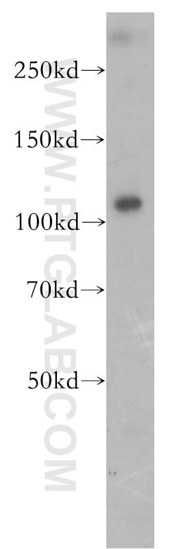 Western Blot (WB) analysis of HL-60 cells using P2RX5 Polyclonal antibody (19012-1-AP)