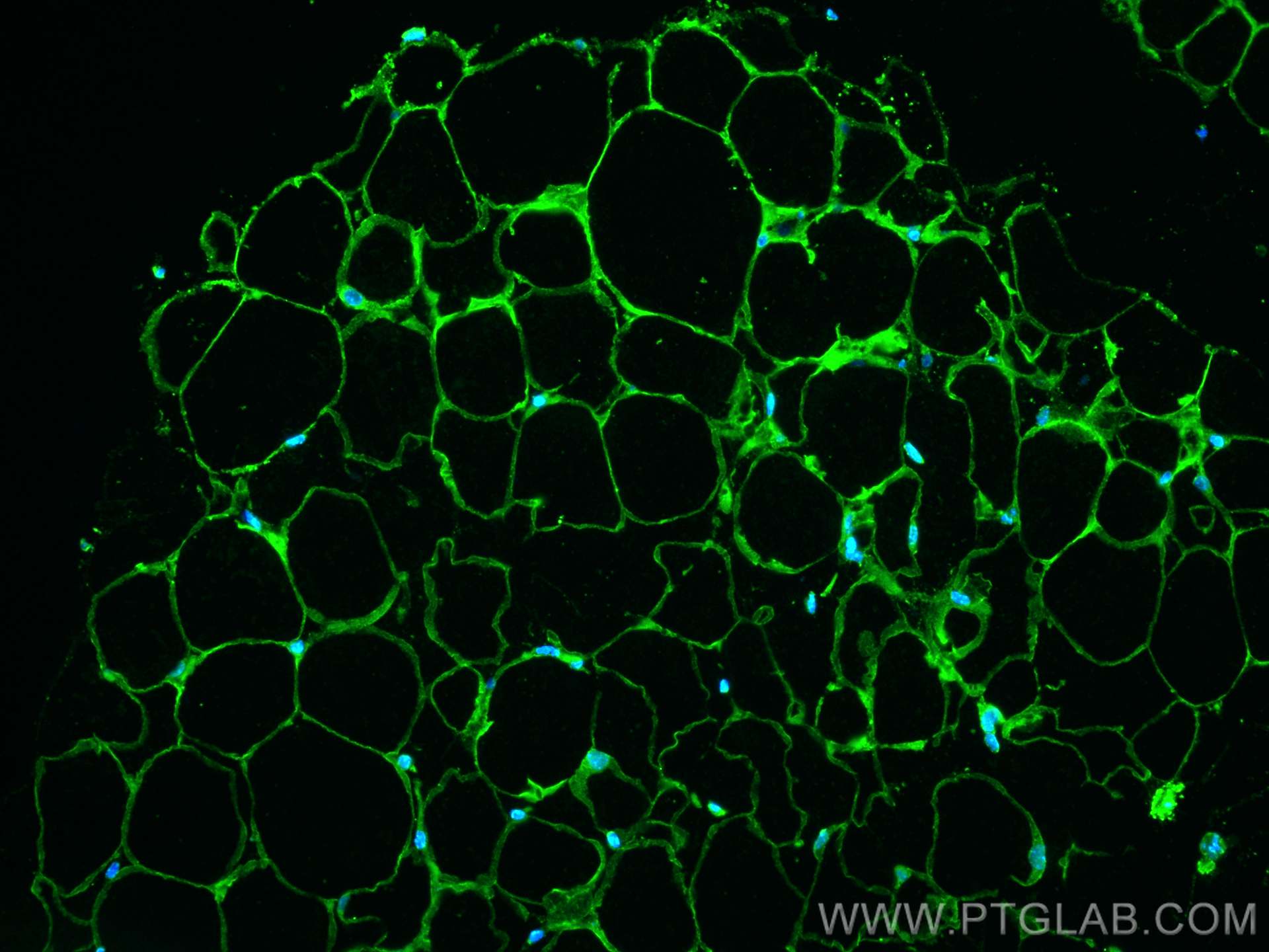 Immunofluorescence (IF) / fluorescent staining of mouse brown adipose tissue using P2RX5 Monoclonal antibody (66430-1-Ig)
