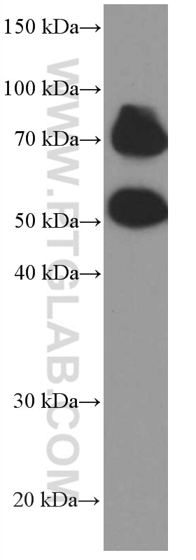 Western Blot (WB) analysis of pig brain tissue using P2RX5 Monoclonal antibody (66430-1-Ig)