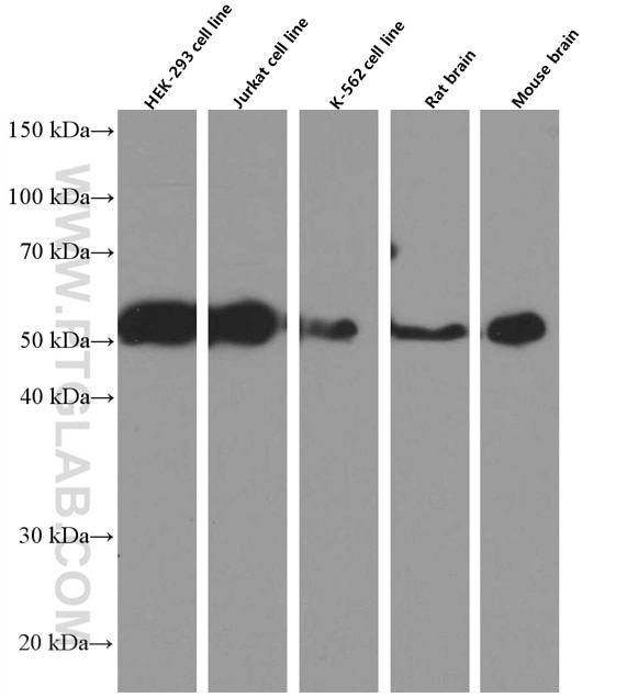 Western Blot (WB) analysis of various lysates using P2RX5 Monoclonal antibody (66430-1-Ig)