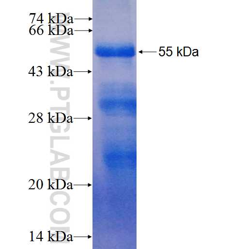 P2RX5 fusion protein Ag5297 SDS-PAGE
