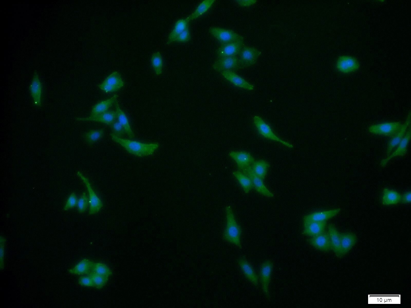 Immunofluorescence (IF) / fluorescent staining of HeLa cells using P2RX7 Polyclonal antibody (11144-1-AP)