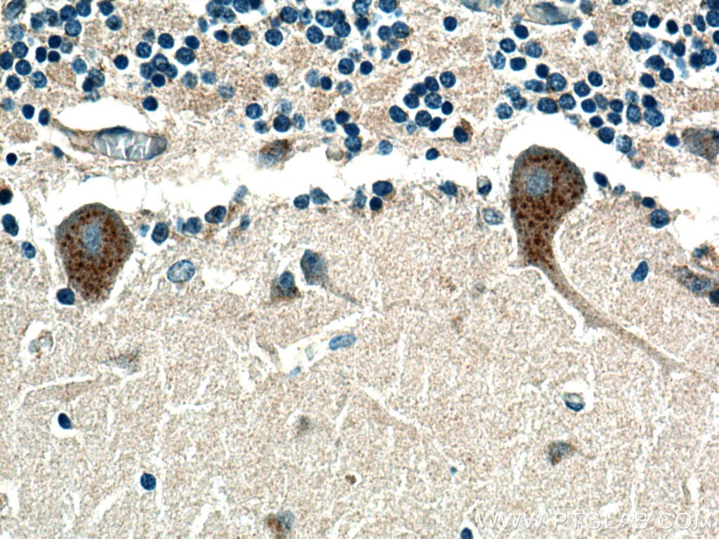 IHC staining of human cerebellum using 28207-1-AP